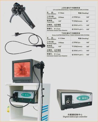 上消化道电子内窥镜 现代医学的“明亮之眼”